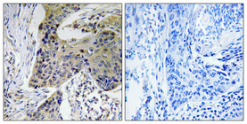 IHC - NF2 Polyclonal Antibody AP71263